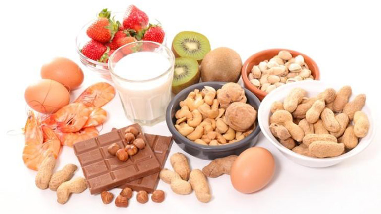 Nổi mề đay do dị ứng thực phẩm