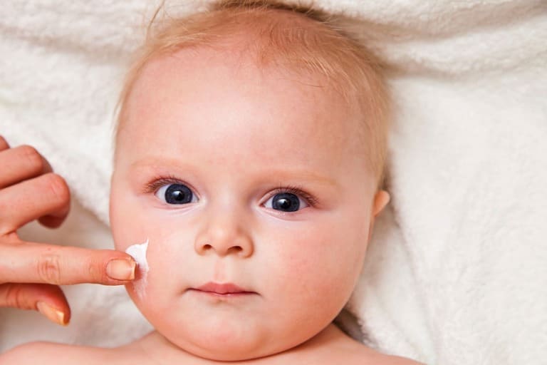 Bệnh á sừng có di truyền không?