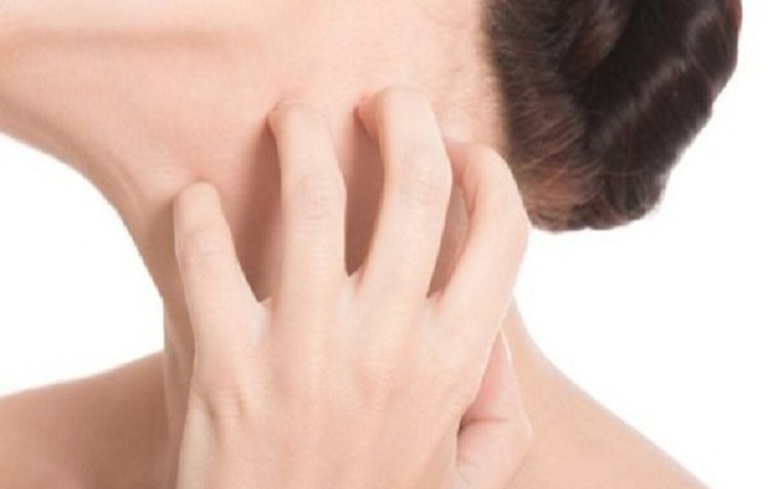 Ngứa ngáy càng gãy càng lan rộng cơn ngứa thường là dấu hiệu ban đầu của một số bệnh lý.
