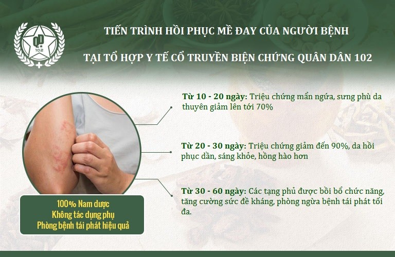 Liệu trình mề đay Quân dân 102 giúp bệnh nhân khỏi bệnh chỉ sau 2 - 3 tháng Liệu trình mề đay Quân dân 102 giúp bệnh nhân khỏi bệnh chỉ sau 2 - 3 tháng