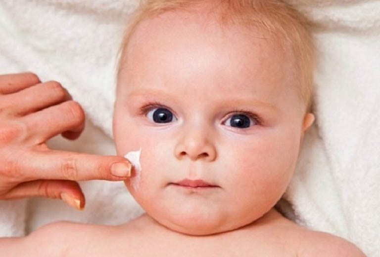 Phương pháp điều trị trẻ sơ sinh bị chàm sữa ở mặt