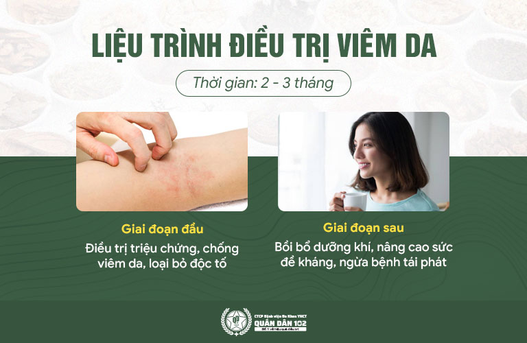 Phác đồ chữa viêm da dầu Quân dân 102 Phác đồ chữa viêm da dầu Quân dân 102