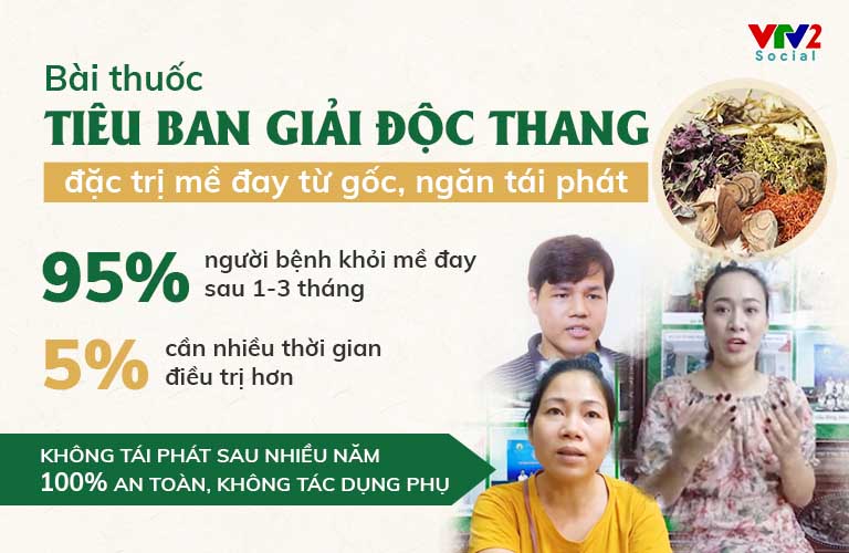 Trên 95% người bệnh dứt điểm mề đay, mẩn ngứa sau 1 liệu trình