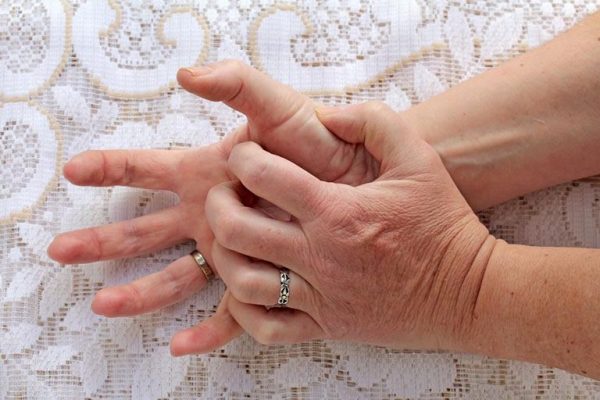 Bệnh tổ đỉa có di truyền không