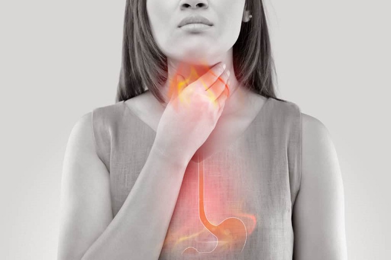 Gây cảm giác đau nhức vùng cổ là một biến chứng thường thấy của bệnh trào ngược dạ dày
