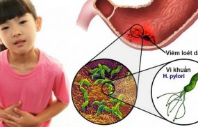 Nhiễm vi khuẩn HP ở trẻ em có thể gây ra các bệnh lý về dạ dày