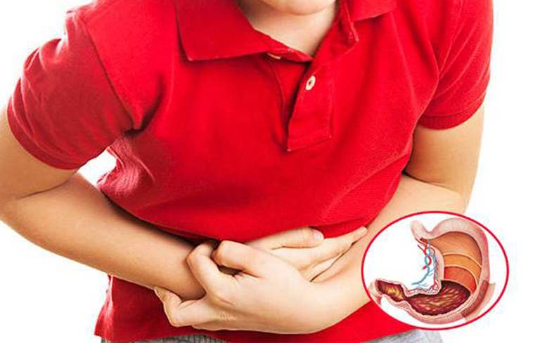 Đau dạ dày cấp là cơn đau đột ngột, dữ dội trong thời gian ngắn Đau dạ dày cấp là cơn đau đột ngột, dữ dội trong thời gian ngắn