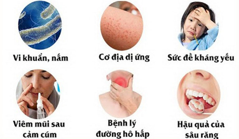 Các nguyên nhân gây ra bệnh viêm đa xoang thường gặp trong đời sống hàng ngày