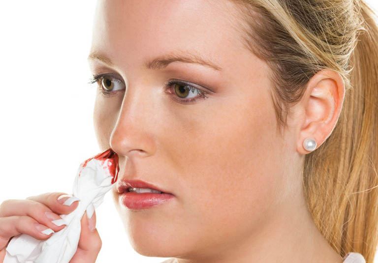 Chảy máu mũi do viêm xoang không được chủ quan trong điều trị để tránh phát sinh biến chứng
