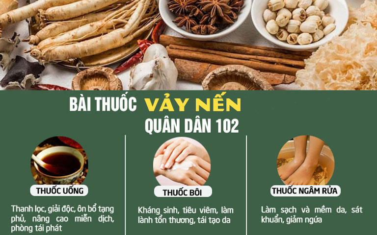 Công thức kết hợp toàn diện trong bài thuốc chữa vảy nến Quân dân 102