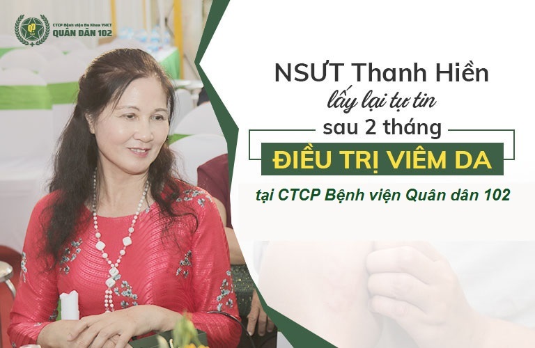 NSUT Thanh Hiền là một trong những bệnh nhân điều trị viêm da thành công nhờ CTCP Bệnh viện Quân dân 102 NSUT Thanh Hiền là một trong những bệnh nhân điều trị viêm da thành công nhờ CTCP Bệnh viện Quân dân 102