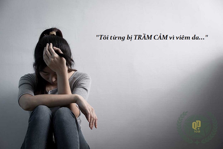 Viêm da là bệnh lý dai dẳng, gây nhiều phiền toái cho người bệnh, thậm chí có thể gây trầm cảm Viêm da là bệnh lý dai dẳng, gây nhiều phiền toái cho người bệnh, thậm chí có thể gây trầm cảm