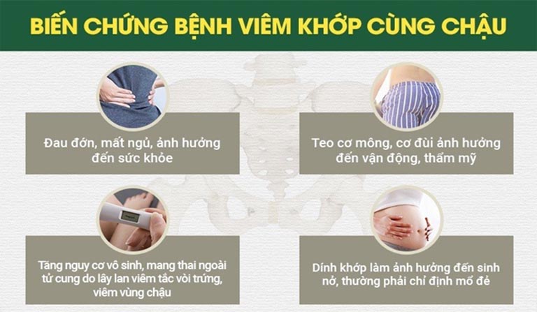 Viêm khớp cùng chậu