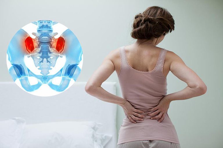 Viêm khớp cùng chậu