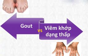 viêm khớp dạng thấp và gout