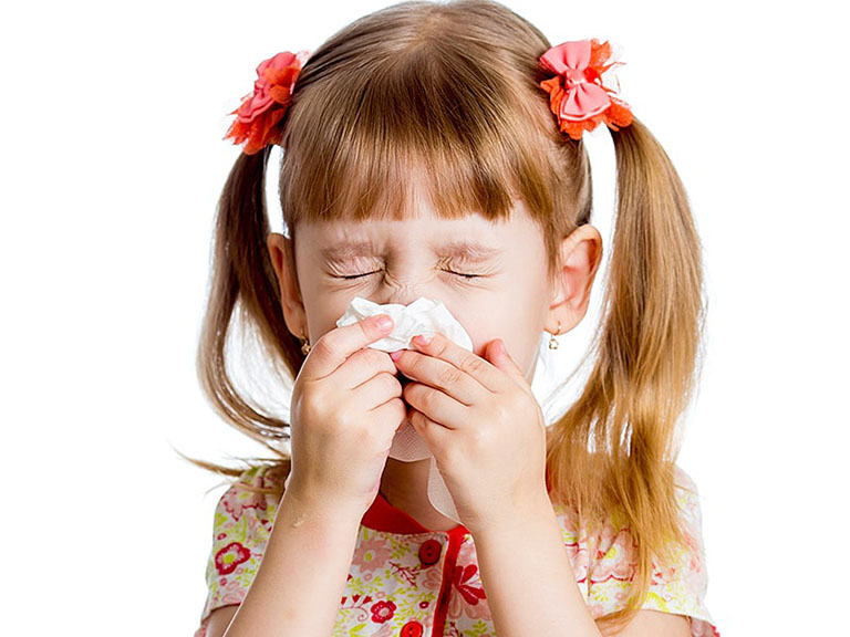 Hắt hơi, xì mũi liên tục là triệu chứng điển hình của bệnh viêm mũi dị ứng
