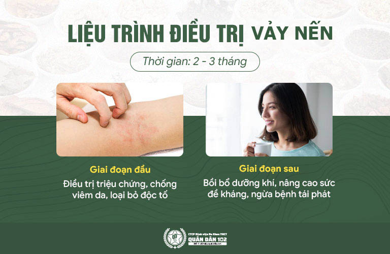 Liệu trình chữa vảy nến Quân dân 102 đem lại hiệu quả toàn diện, trị bệnh tận gốc Liệu trình chữa vảy nến Quân dân 102 đem lại hiệu quả toàn diện, trị bệnh tận gốc
