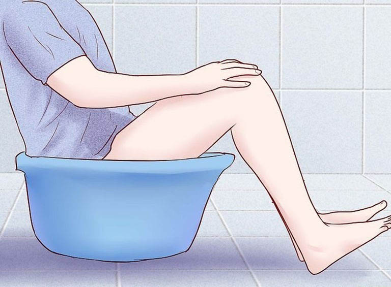 Đẩy lùi triệu chứng sau đau búi trĩ tại nhà bằng cách ngâm hậu môn trong nước ấm