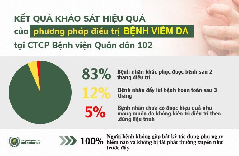Tỷ lệ điều trị viêm da thành công tại CTCP Bệnh viện Quân dân 102 luôn ở mức cao Tỷ lệ điều trị viêm da thành công tại CTCP Bệnh viện Quân dân 102 luôn ở mức cao