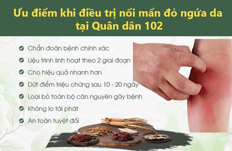 Ưu điểm khi xử lý nổi mẩn đỏ ngứa da tại Quân dân 102