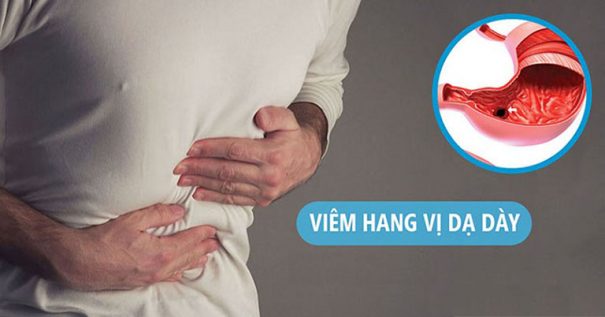 thuốc chữa viêm hang vị dạ dày