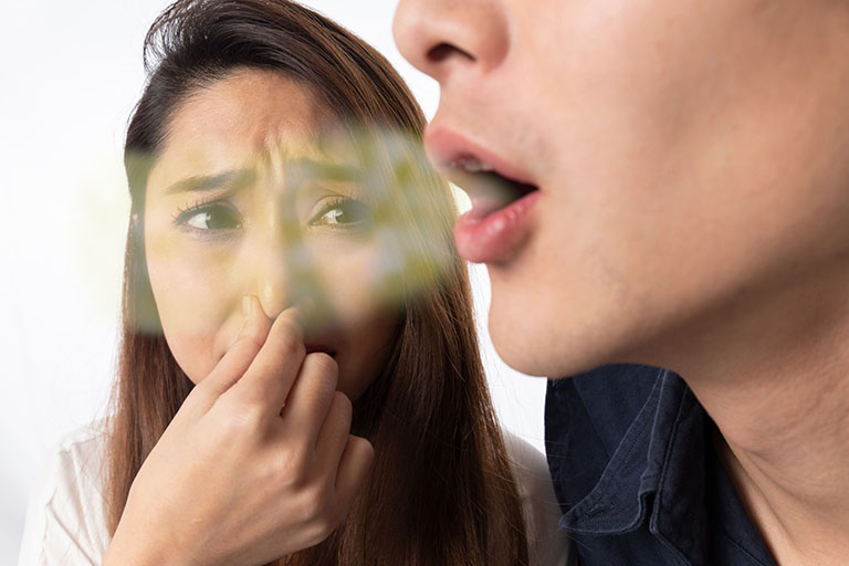 Hôi miệng là một trong những triệu chứng thường gặp của bệnh viêm amidan hốc mủ bã đậu