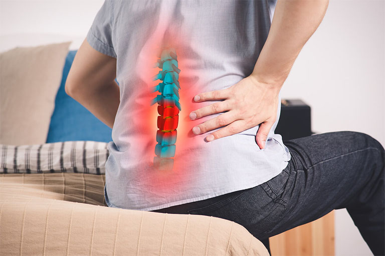 Chia sẻ các cách giảm đau lưng do thoái hóa cột sống hiệu quả ngay tại nhà 
