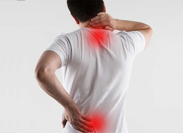 Thoái hóa cột sống là bệnh xương khớp mãn tính, có khả năng xuất hiện tập trung ở vùng cổ và thắt lưng