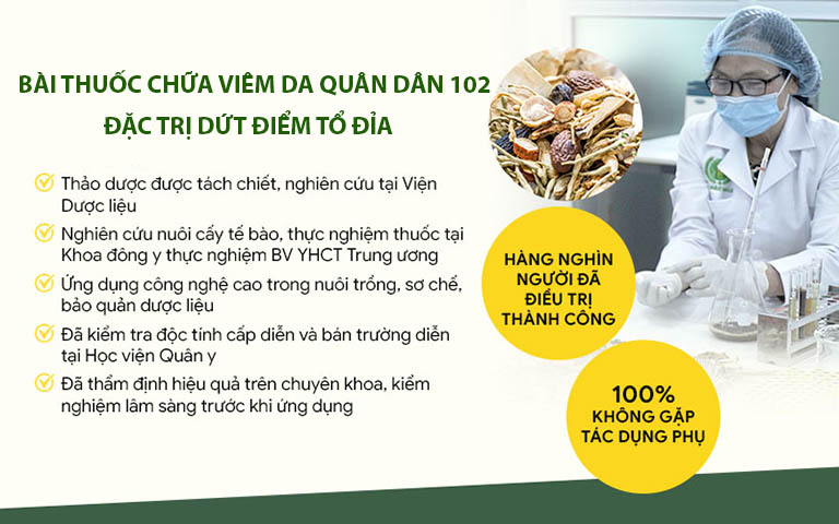 Bài thuốc chữa viêm da Quân dân 102 đã được kiểm nghiệm đầy đủ Bài thuốc chữa viêm da Quân dân 102 đã được kiểm nghiệm đầy đủ