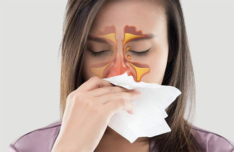 Nếu không được điều trị bệnh có thể biến chứng thành viêm xoang