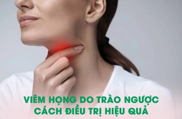 viêm họng do trào ngược