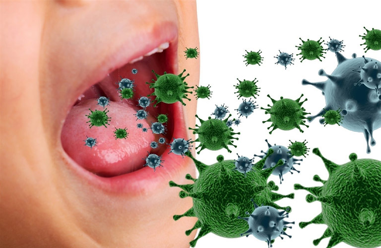 Viêm mũi họng thường do virus, vi khuẩn gây ra